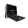 УЗИ АППАРАТ ELS-500-T