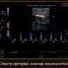 УЗИ АППАРАТ ELS-500 T-CS